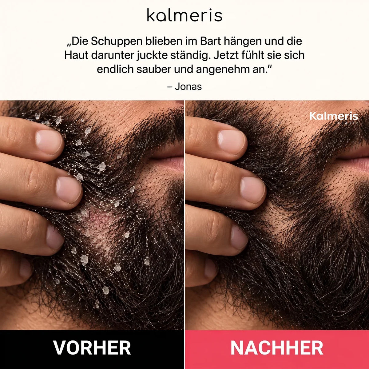 Bart- und Kopfhaut-Peeling 4