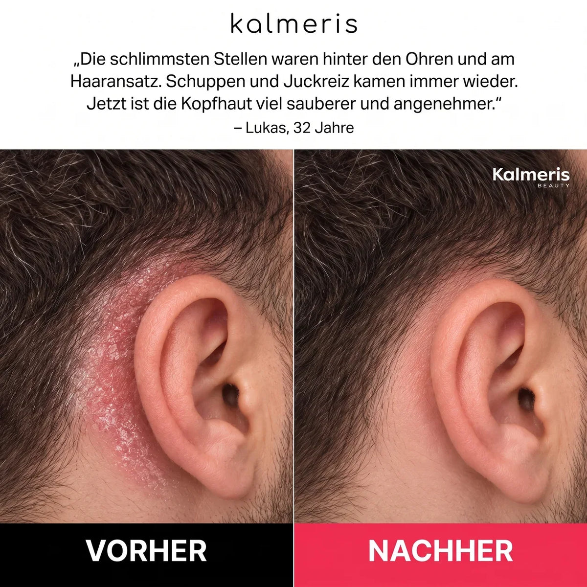 Bart- und Kopfhaut-Peeling 5